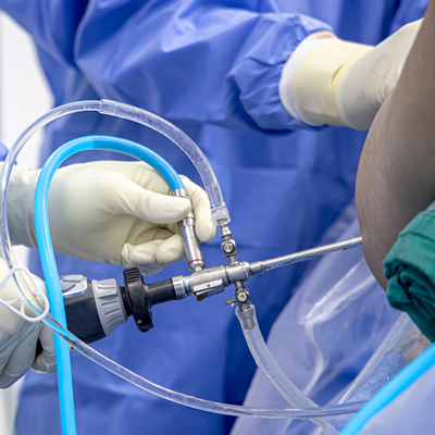 Joint Arthroscopy