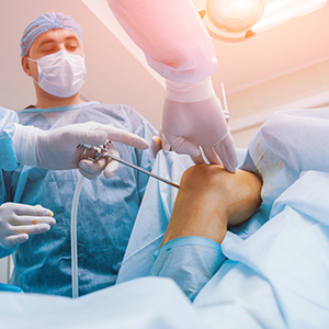 arthroplasty